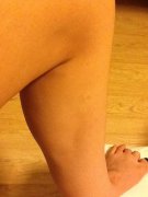 深圳美莱整形失败，却投诉无门？