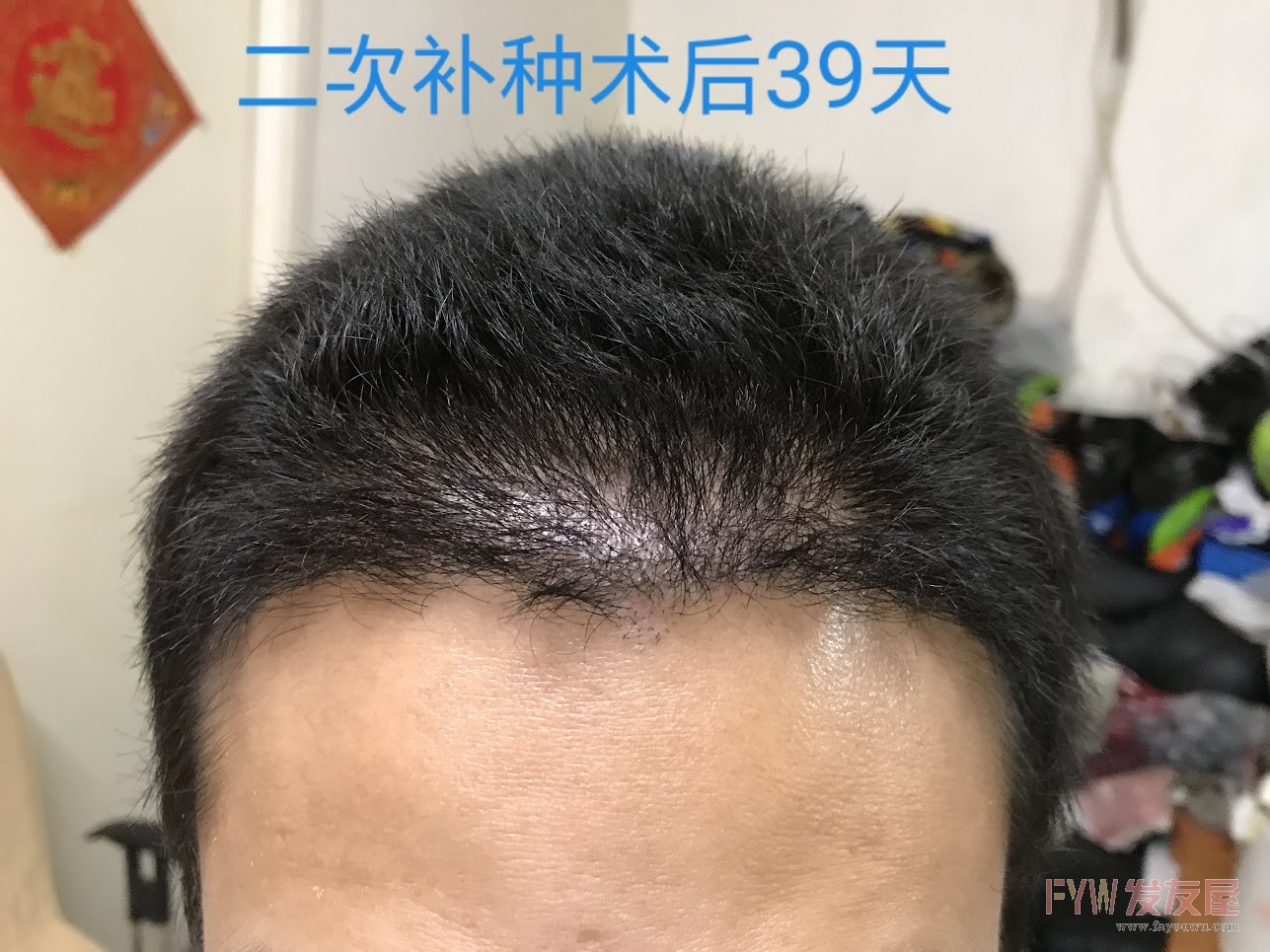 20181113_041206.jpg